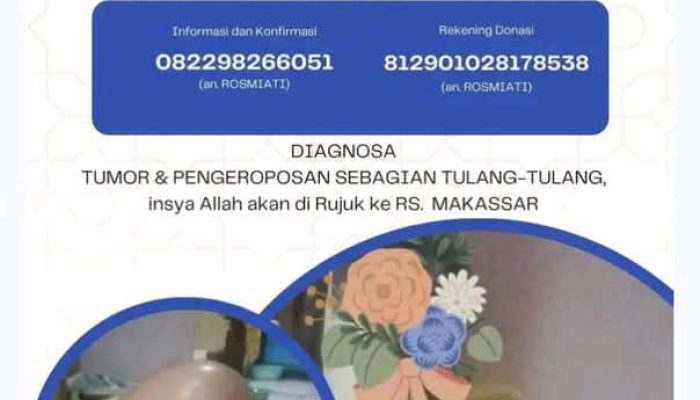 Bantuan Darurat Untuk Edy Swandy: Anak Berjuang Melawan Tumor dan Pengeroposan Tulang di Pota Manggarai Timur, Pemda Matim Diminta Uluran Tangannya! 
